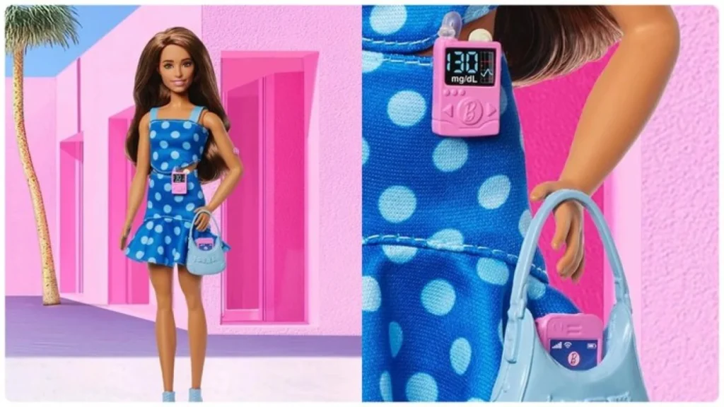Barbie Luncurkan Koleksi Boneka untuk Anak Pengidap Diabetes Tipe 1