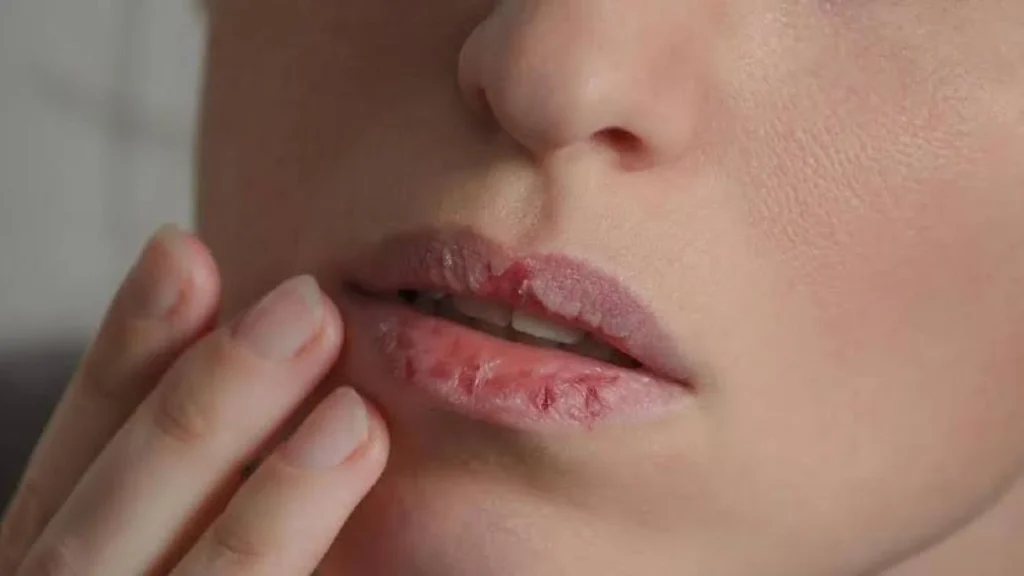 Tips Merawat Bibir Agar Tetap Sehat dan Terhidrasi